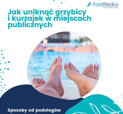 Jak uniknąć grzybicy i kurzajek w miejscach publicznych